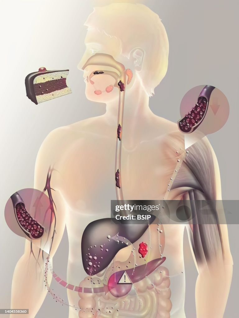 Diabetes, drawing