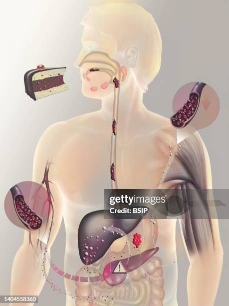 Secretion of insulin on a person with diabetes type 2. Diabetes type 2 is a form of diabetes mellitus affecting mainly adults over 40 due to a food...