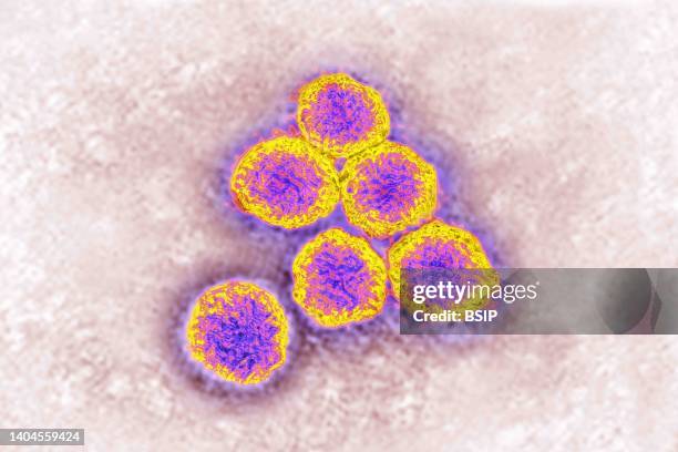 Flavivirus , these viruses are responsible for yellow fever, dengue fever, Japanese encephalitis, Zika virus, West Nile encephalitis. They are...