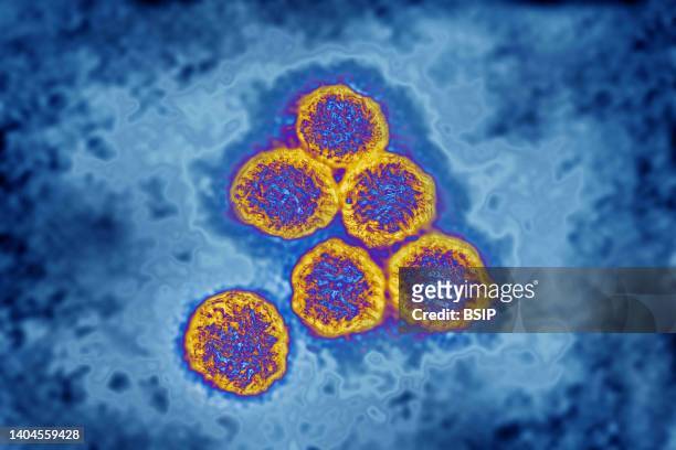 Flavivirus , these viruses are responsible for yellow fever, dengue fever, Japanese encephalitis, Zika virus, West Nile encephalitis. They are...