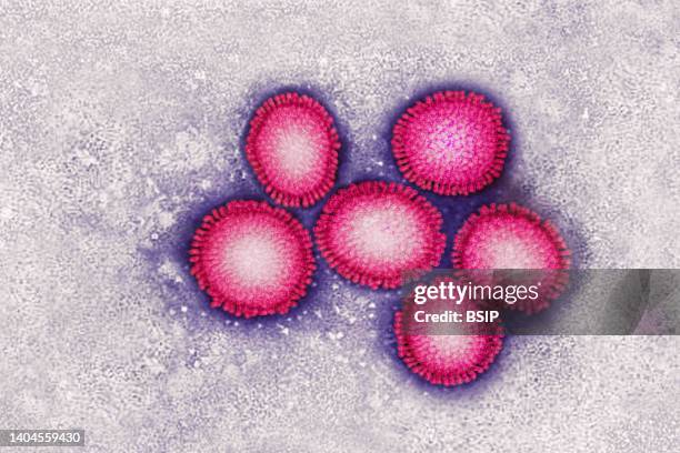 Fluvirus - Influenza virus or Influenza virus. The influenza virus causes the seasonal flu, with in humans, a set of symptoms associating: fever,...