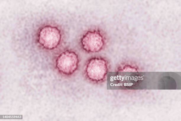 Hepatitis A virus . The HAV. Almost always causes mild hepatitis. View produced from a transmission electron microscopy image. Viral diameter...