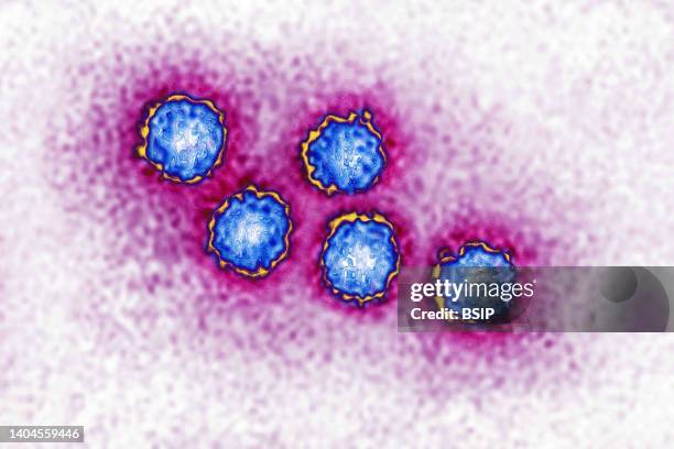 Hepatitis A virus . The HAV. Almost always causes mild hepatitis. View produced from a transmission electron microscopy image. Viral diameter...