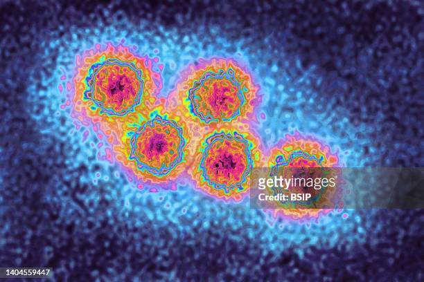Hepatitis A virus . The HAV. Almost always causes mild hepatitis. View produced from a transmission electron microscopy image. Viral diameter...