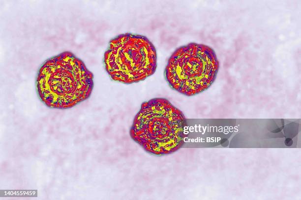 Hepatitis C virus . HCV causes blood-borne hepatitis, cirrhosis occurs in 25% of cases, 10 to 20 years after the onset of infection, with a risk of...