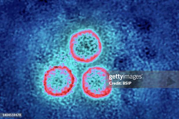 The human papillomavirus or papillomavirus is the cause of sexually transmitted infections . They are also the cause of skin infections: warts. View...