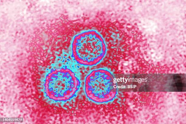The human papillomavirus or papillomavirus is the cause of sexually transmitted infections . They are also the cause of skin infections: warts. View...