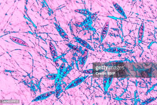 Microsporum canis is a species of fungus of the genus Microsporum responsible for the majority of cases of ringworm in dogs and cats, and in humans....