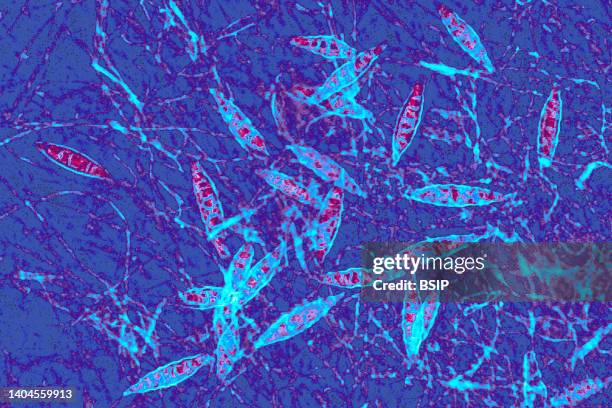 Microsporum canis is a species of fungus of the genus Microsporum responsible for the majority of cases of ringworm in dogs and cats, and in humans....