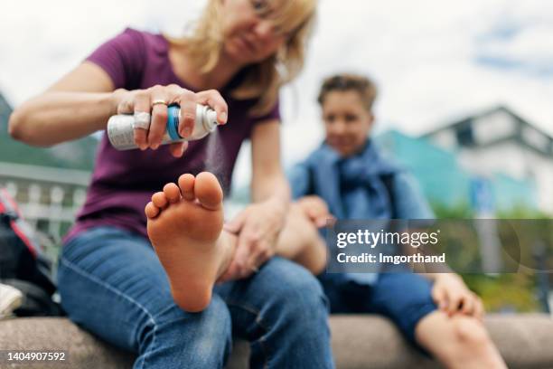 mutter kümmert sich mit gefriernebel um den verwundeten fuß ihres sohnes - wunde stock-fotos und bilder