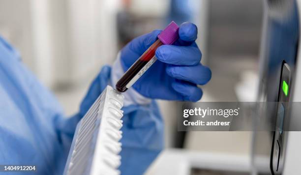 close-up on a technician analyzing blood samples at the lab - blood collection tube stock pictures, royalty-free photos & images