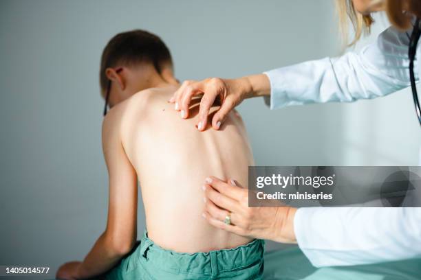 close up shot of young boyâs back getting checked at the doctorâs - menselijke ruggenwervel stockfoto's en -beelden
