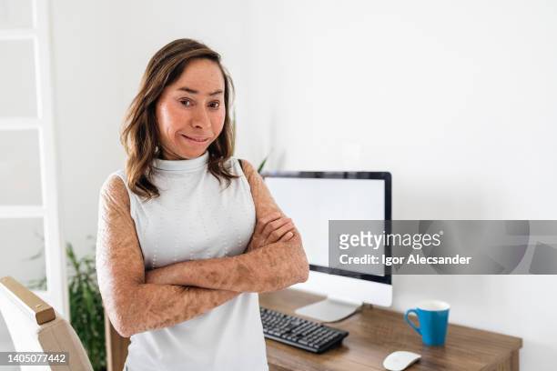 woman with ichthyosis - ichthyosis stock pictures, royalty-free photos & images