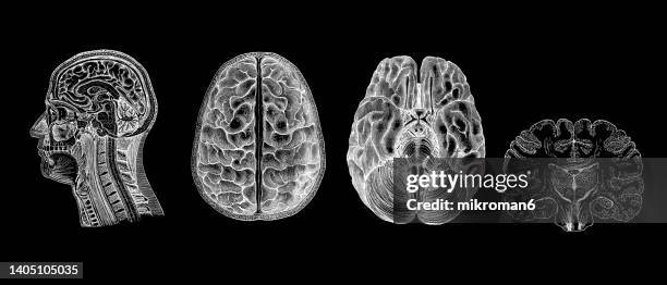 old engraved illustration of human brain - neurosurgery stock-fotos und bilder
