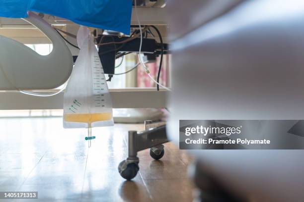 urine or pee catheter bag hang under patient bed in hospital. medical concept. - pistas stockfoto's en -beelden