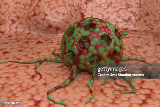cancer cell on the inner layer of tissues. - intestino delgado - fotografias e filmes do acervo