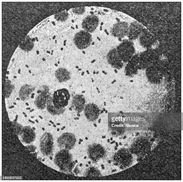 ilustrações, clipart, desenhos animados e ícones de foto antiga: praga no sangue, imagem de microscópio - peste bubônica