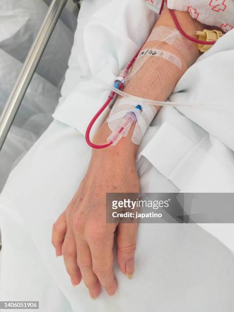 blood transfusion - menschlicher arm stock-fotos und bilder