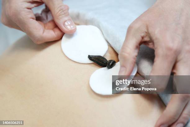 woman taking medicinal leeches therapy for best fertility - leach stock-fotos und bilder