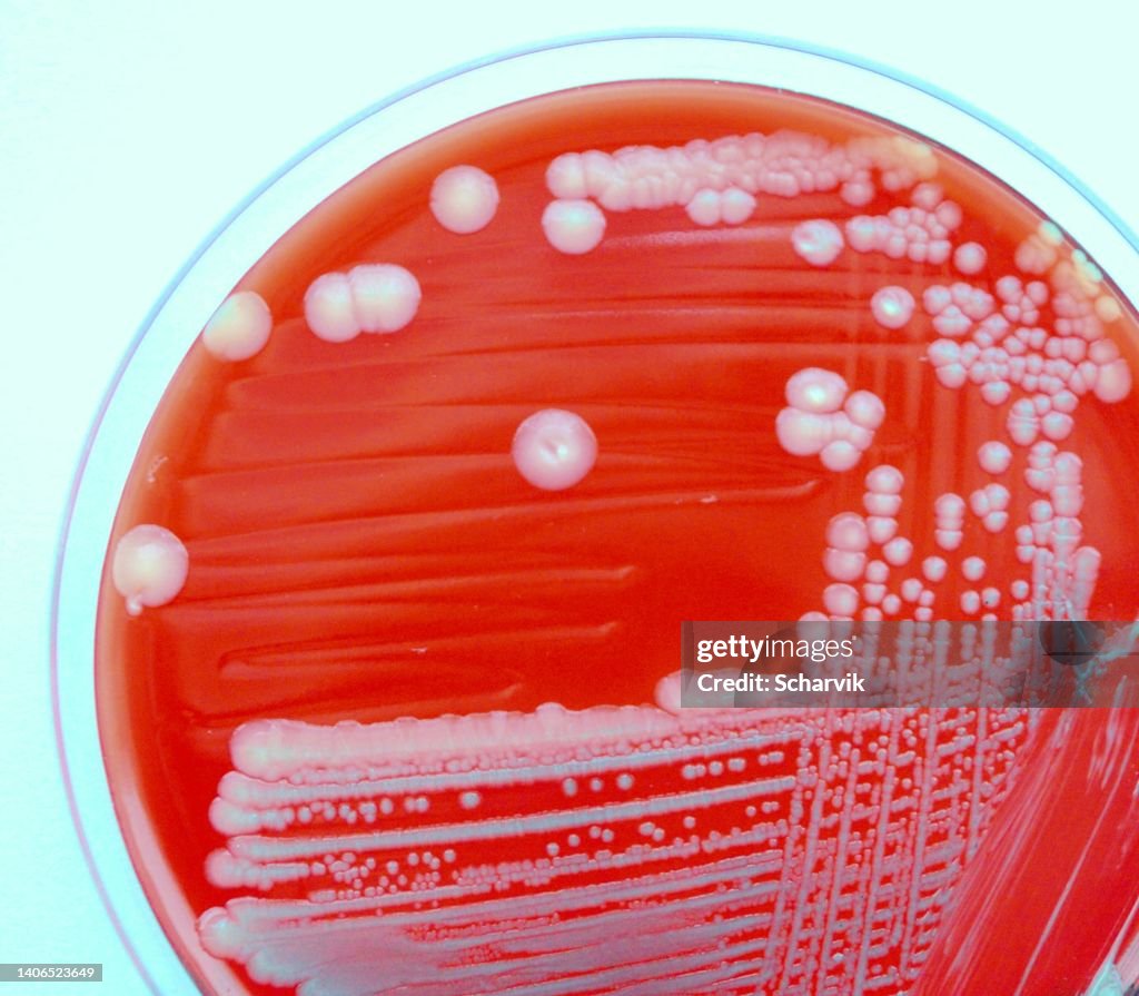 Enterotoxigenic E. coli (ETEC)
