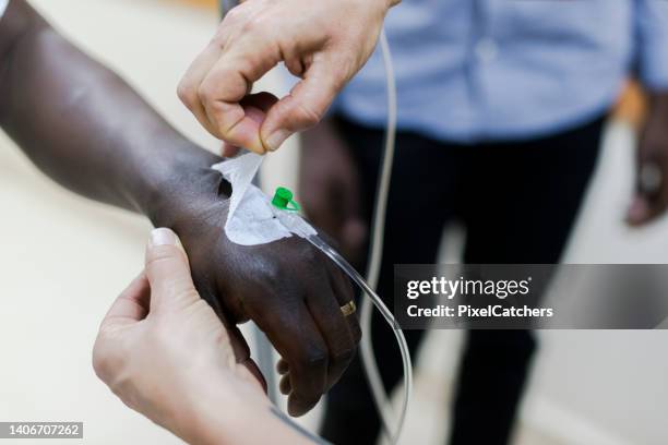 close up nurse removing iv from hand in hospital - iv going into an arm stock pictures, royalty-free photos & images