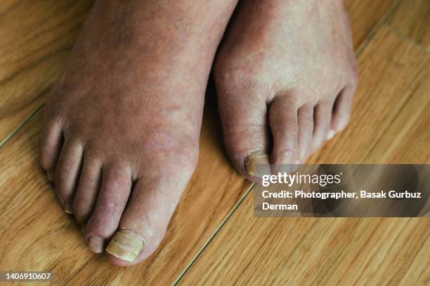 close-up of senior man feet on floor - foot fungus stock pictures, royalty-free photos & images