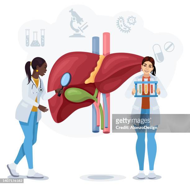 stockillustraties, clipart, cartoons en iconen met female doctors examining human liver. - gal