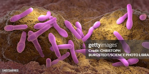 Clostridium botulinum growing on tissue, illustration Clostridium botulinum growing on tissue, illustration
