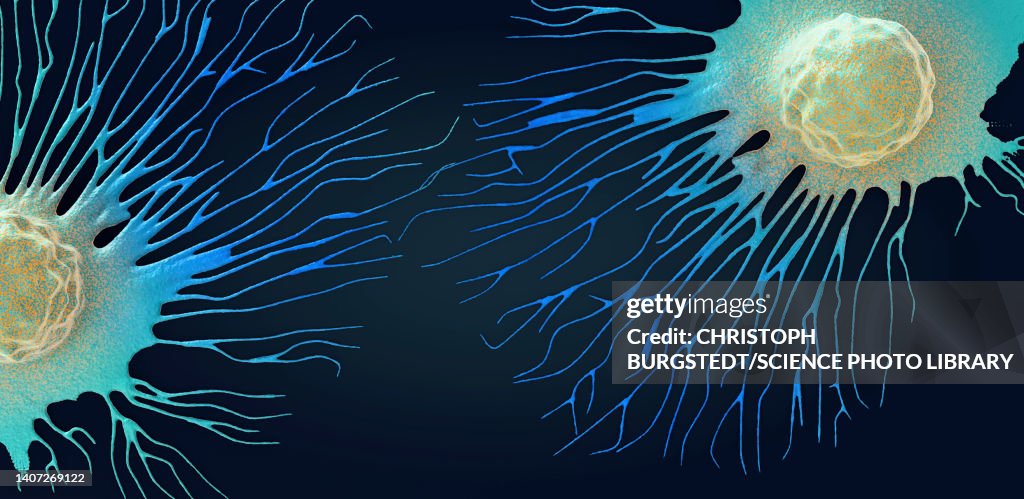 Spreading cancer cell, illustration