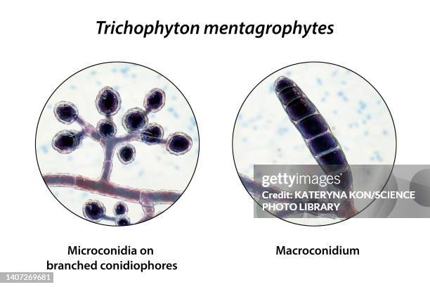 fungi trichophyton mentagrophytes, illustration - trichophyton fungus stock illustrations