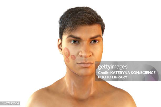 ringworm, illustration - man scratching stock illustrations