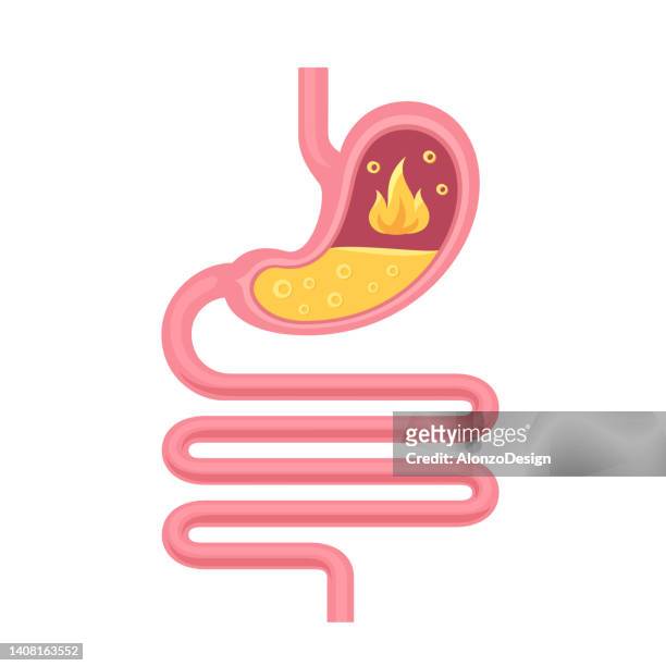 ilustrações, clipart, desenhos animados e ícones de refluxo ácido, pirose ou conceito de azia. anatomia do estômago humano. trato gastrointestinal e sistema digestivo. - esôfago sistema digestivo