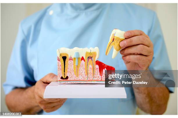 dentist holding model teeth - gingivitis stock-fotos und bilder