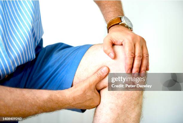 man massaging painful knee - knee replacement surgery stock pictures, royalty-free photos & images