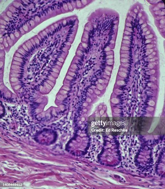 villi in the small intestine (ileum, human), simple columnar epithelium and intestinal glands, 50x - ghiandola intestinale foto e immagini stock