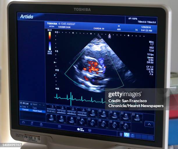 Echogram Display Echocardiography Photos and Premium High Res Pictures - Getty Images