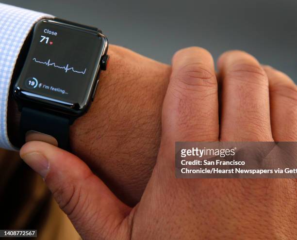 AliveCor president and CEO Vic Gundotra rests his thumb on a wristband sensor to check his heart rate in Mountain View, Calif. On Thursday, Dec. 7,...