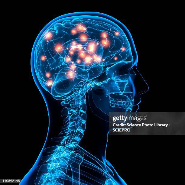 ilustraciones, imágenes clip art, dibujos animados e iconos de stock de brain activity, artwork - imagen de rayos x