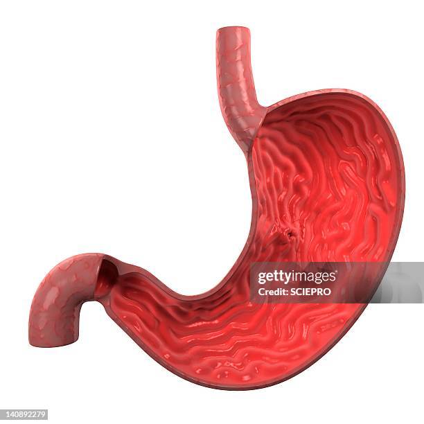 stomach ulcer, artwork - ulcer stock illustrations