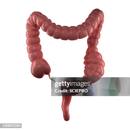 Constipated colon, artwork Constipated colon, artwork
