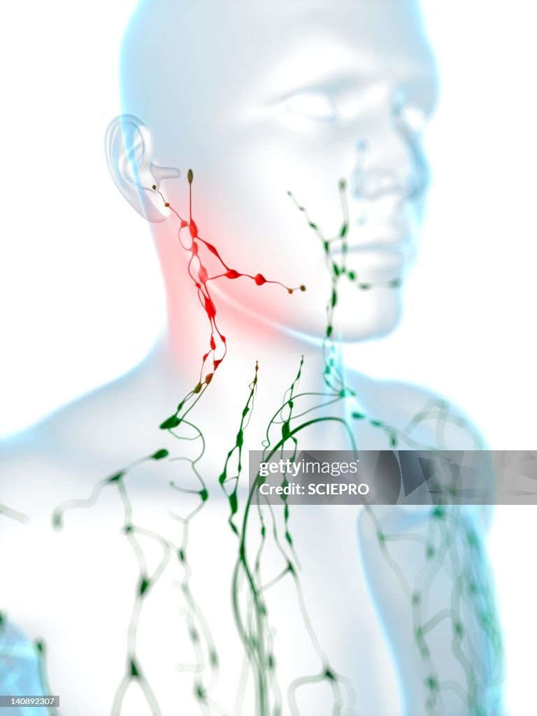 Swollen lymph nodes, artwork