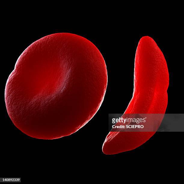 illustrazioni stock, clip art, cartoni animati e icone di tendenza di sickle cell anaemia, artwork - globulo rosso