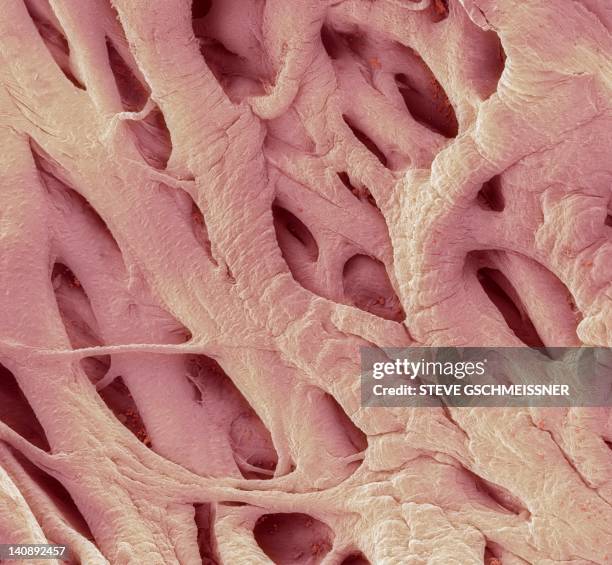 heart strings, sem - vue au microscope électronique à balayage en réflexion photos et images de collection