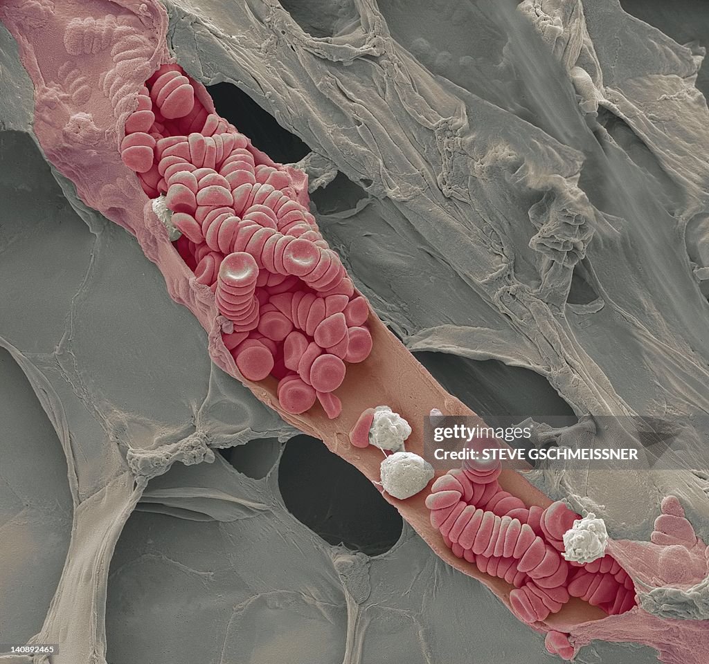 Ruptured venule, SEM