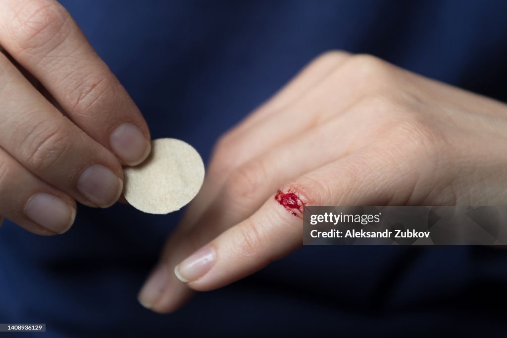 A Damaged And Cut Finger On The Hand A Woman Sticks A Medical Plaster For  Disinfection The Girl Cut Her Finger Presses The Bandage To The Wound To  Stop The Bleeding And