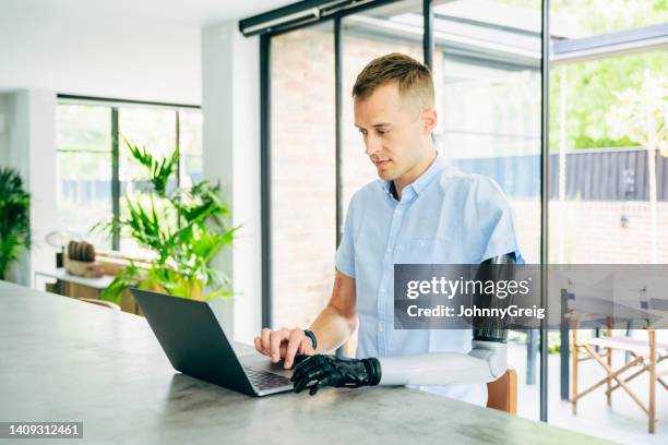 telecommuting businessman wearing prosthesis - prosthetic equipment stock pictures, royalty-free photos & images