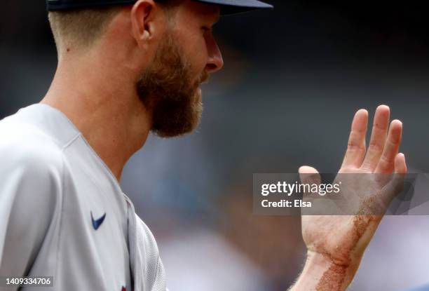 Chris Sale of the Boston Red Sox leaves the field with a dislocated pinky finger after getting hit by a line drive from Aaron Hicks of the New York...