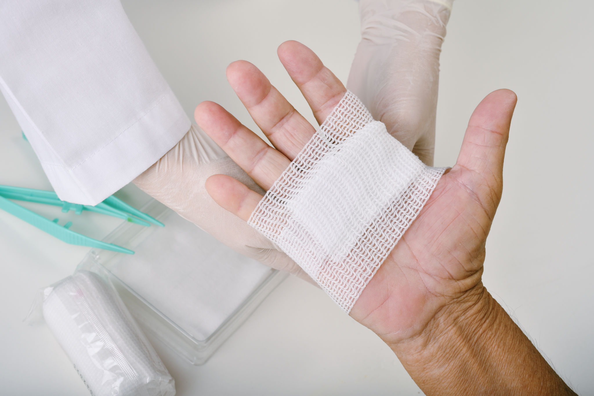 wound dressing