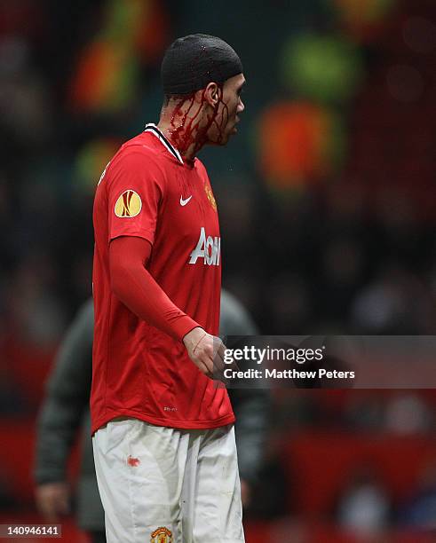 Chris Smalling of Manchester United leaves the pitch with a blood injury during the UEFA Europa League Round of 16 first leg match between Manchester...