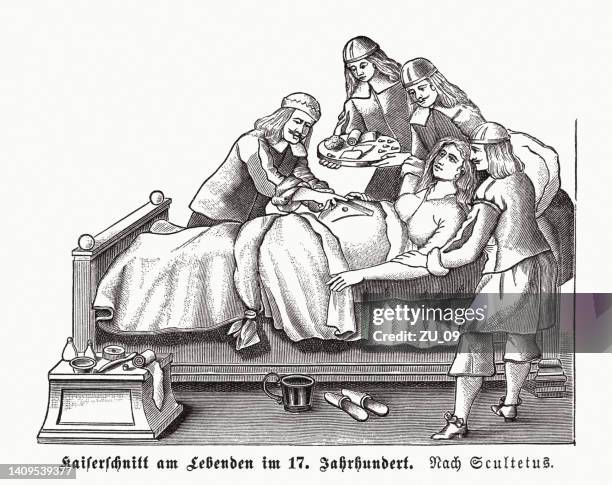 stockillustraties, clipart, cartoons en iconen met caesarean section (17th century), wood engraving, published in 1891 - messinstrument